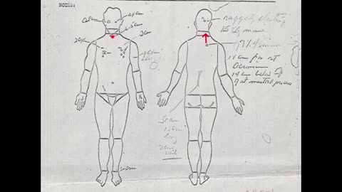 The JFK Shooting Explained