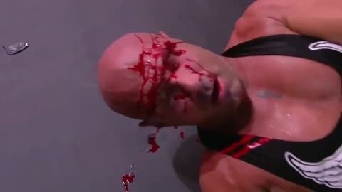 bad idea number 11,200. superkick eye shot