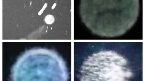 Orbs With Faces