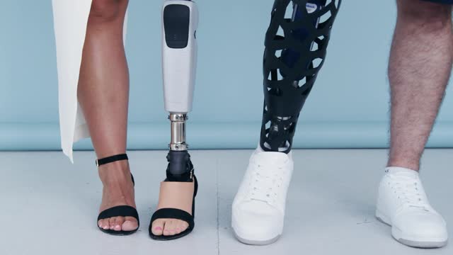 modern artificial legs