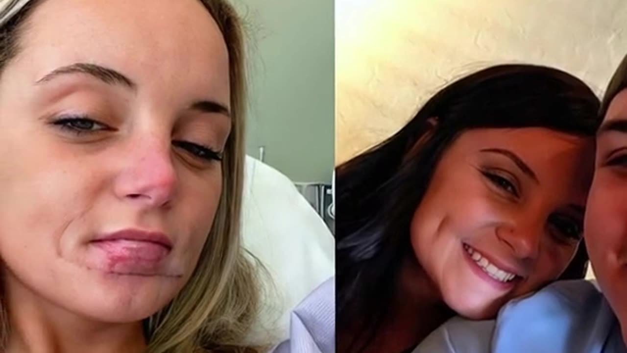 Man bites off ex-girlfriend's lip after breaking up with her