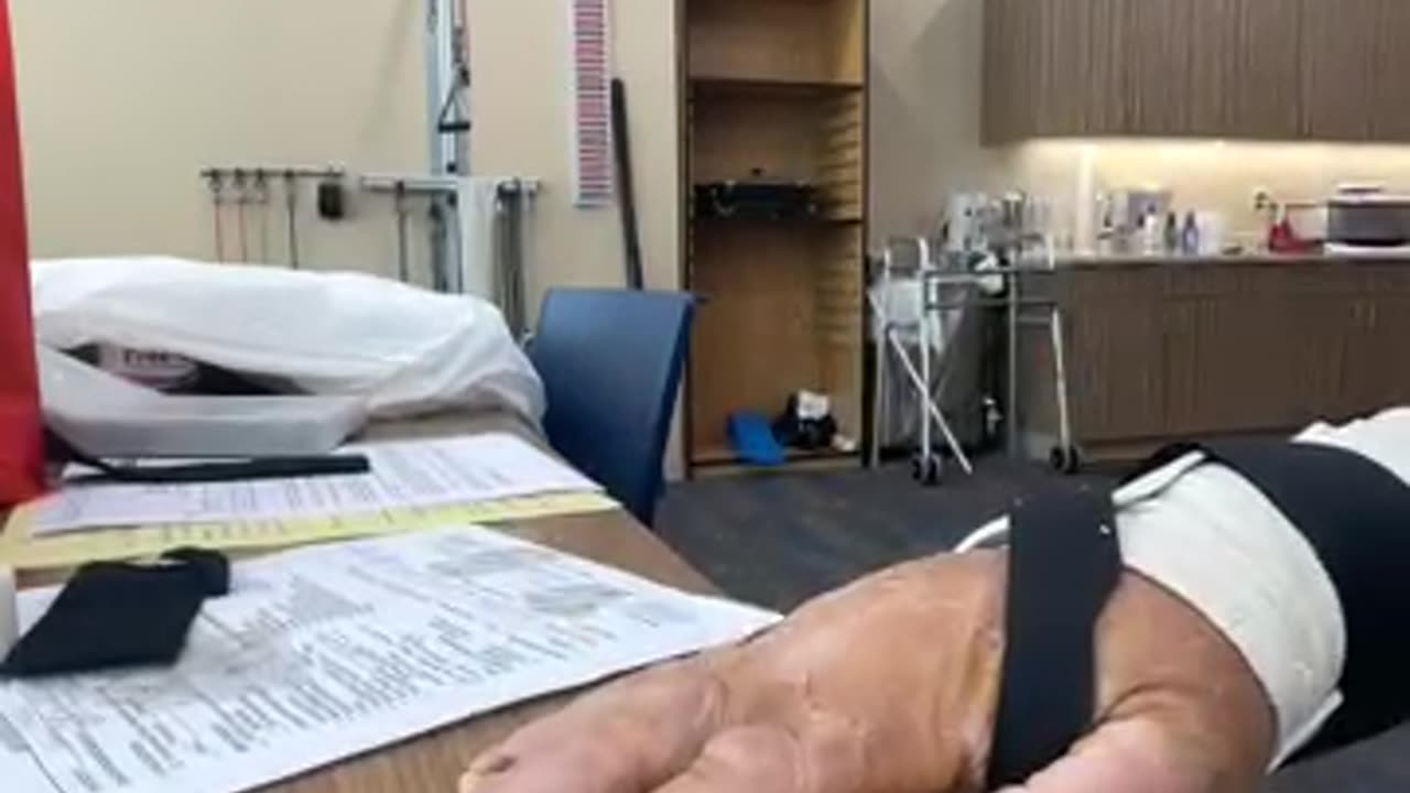 Shit ton o stitches out