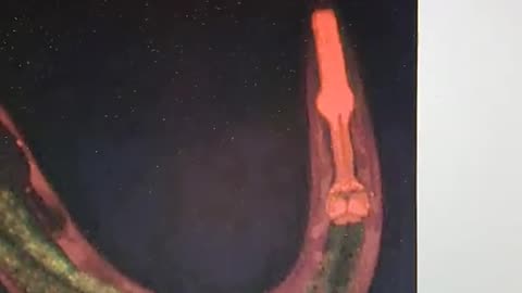 Worm psychology