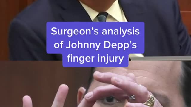 Surgeon's analysis of Johnny Depp's finger injury