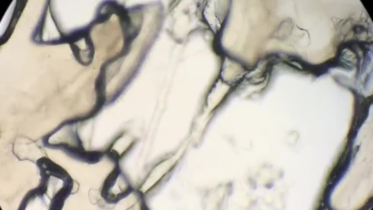 Would you dare to eat pork magnified 400 times under a microscope