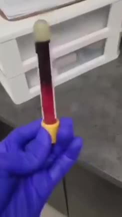 BLOOD CLOTS IN 3 MINUTES AFTER DEATH VAX