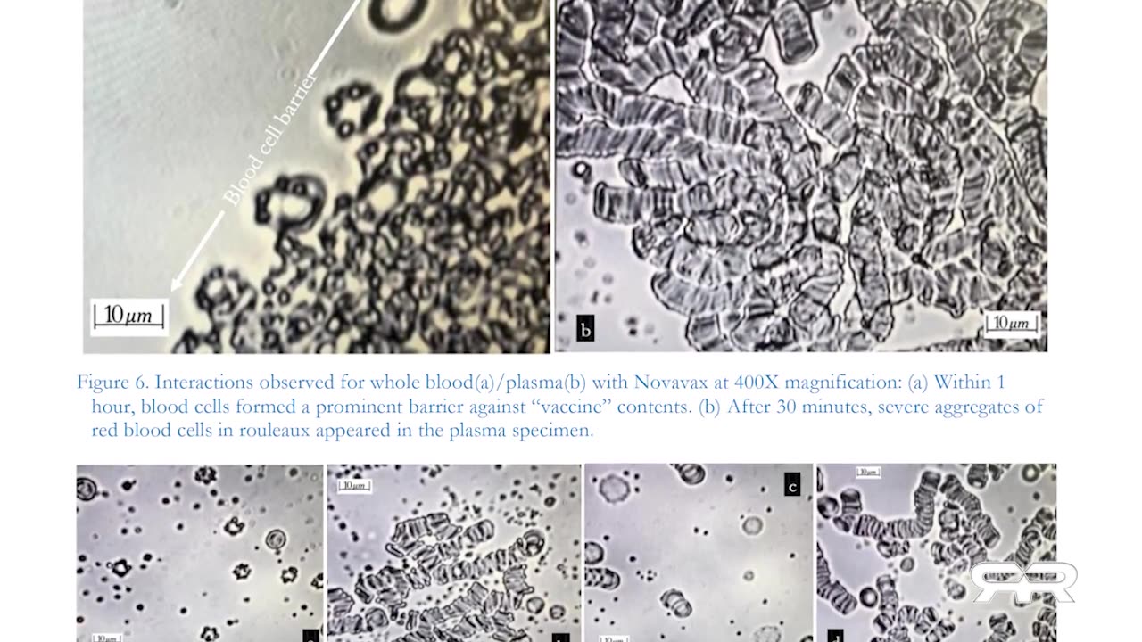 Recent Study Shows Self-Assembly Nanobots in the COVID-19 Injectables- REESE REPORT