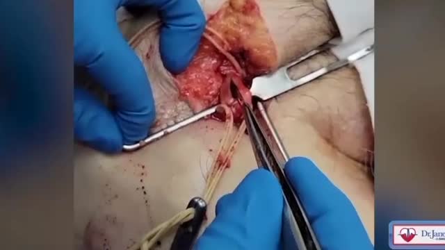 Blood clots seem to be everywhere...No wonder these people are not surviving