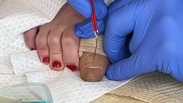 That came out of her TOE-!
