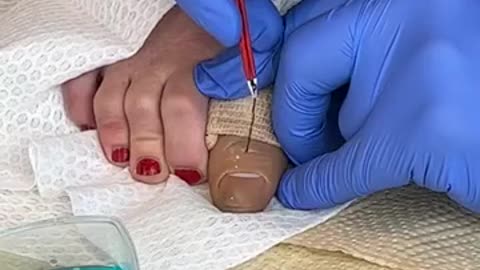 That came out of her TOE-!