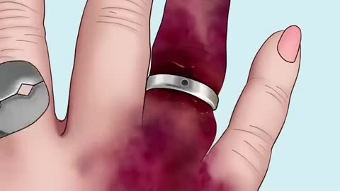 Hand Treatment So Satisfying P1 #satisfying #trendingshort #viral #shorts #trending Duration