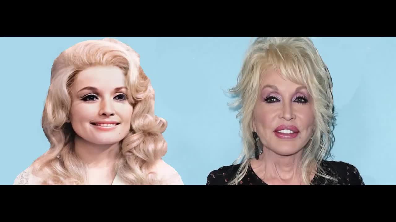 DOLLY PARTON BEFORE AND AFTER