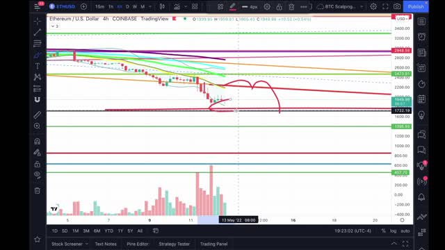 Is The Dump Over? Bitcoin (BTC) & Ethereum (ETH) Daily Close Update... WATCH NOW!!! CANT MISS THIS!!