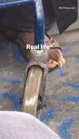 Man with blue walker long overgrown toe nails