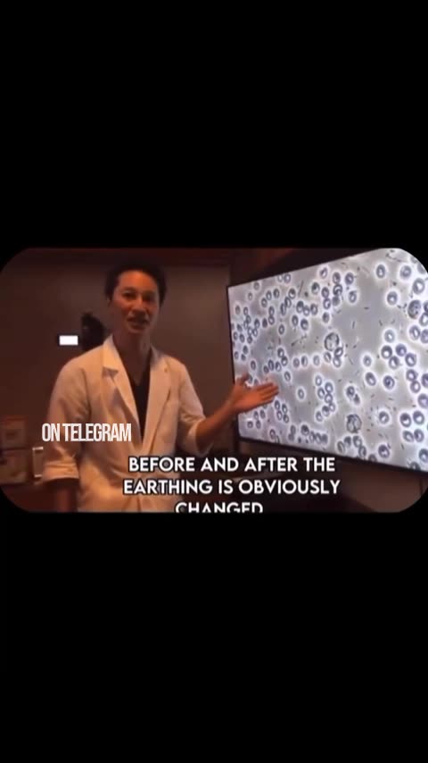 The difference in Blood after earthing or grounding by Awakened Species