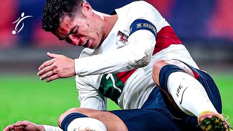 VERY HARD SHOCK to CRISTIANO RONALDO that LEFT him like that 🤕📸