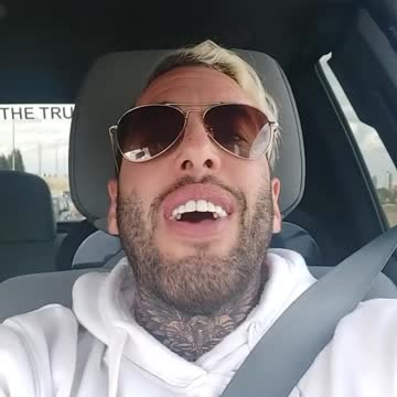 Monkeypox is is side effect of vaccines: shingles