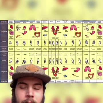 Interesting - Wisdom Teeth