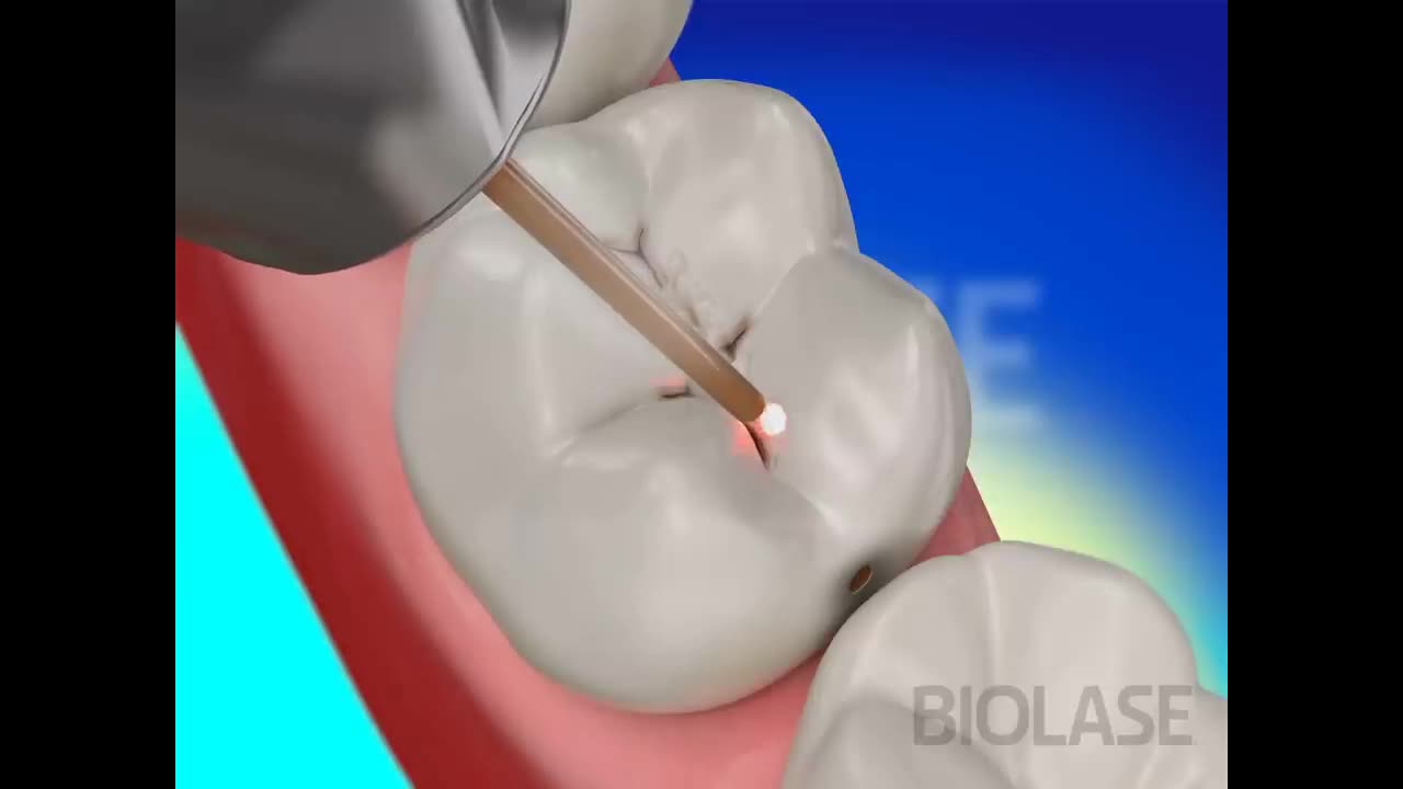 Teeth Restoration | Amazing Video