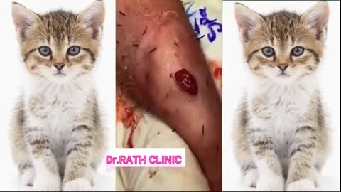 Satisfying Pimple Popping Videos