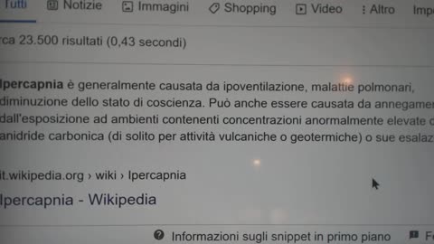 2020.09.15-Eliseo.Bonanno-CONSEGUENZE ECCESSIVA ANIDRIDE CARBONICA MASCHERINA IPERCAPNIA ACIDOSI