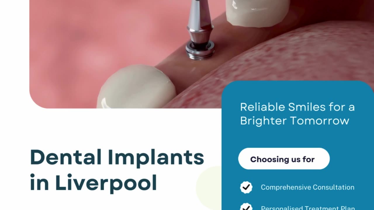 Rediscover Confidence with Expert Dental Implants in Liverpool