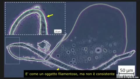 Siero genico al microscopio