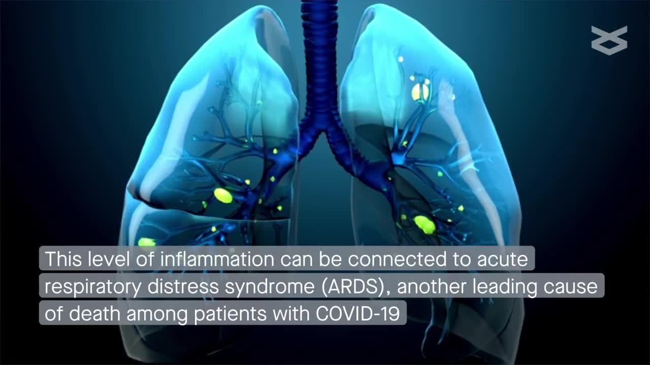 Phosphatidylserine inside out: inflammation and coagulation abnormalities in COVID-19