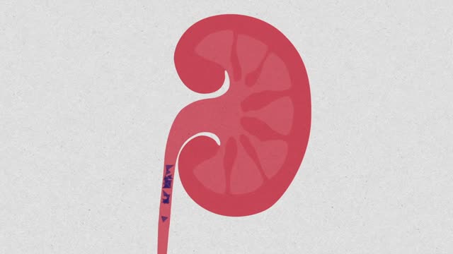 What causes kidney stones?