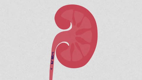 What causes kidney stones?