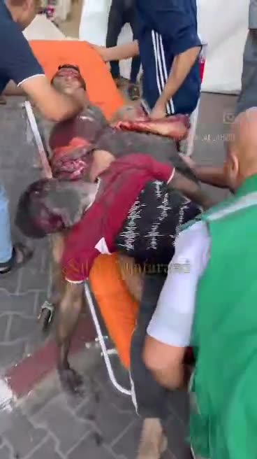 Horrific Scenes from a Gaza Hospital after Israeli bombing of the city