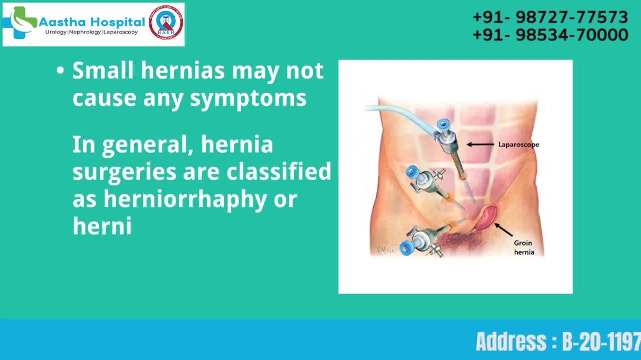 Hernioplasty Surgery at Aastha Kidney & Super Speciality Hospital