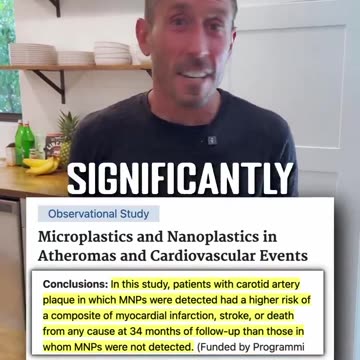 Say "Cheese", Keep smiling