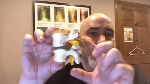 Can Chiropractic Help Severe Sciatica? - Ask A Chiropractor Video FAQs