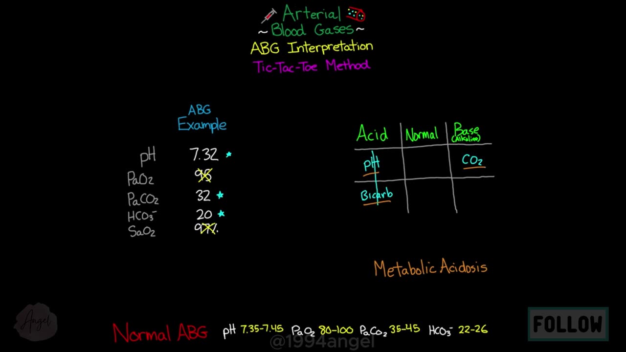 Tic Tac Toe Method _ Arterial Blood Gases (Part 5)