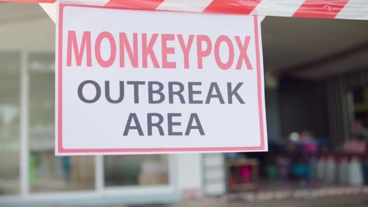 Interesting facts you need to know about Monkeypox