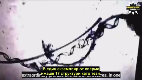 Нано-технологията е също и в спермата на ваксинираните