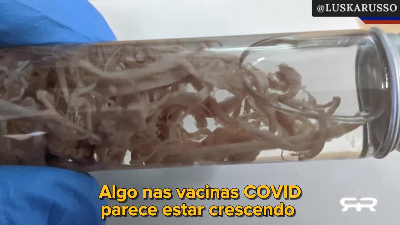 Bio-Estruturas Maciças Encontradas Nos Corpos Dos Vacinados.