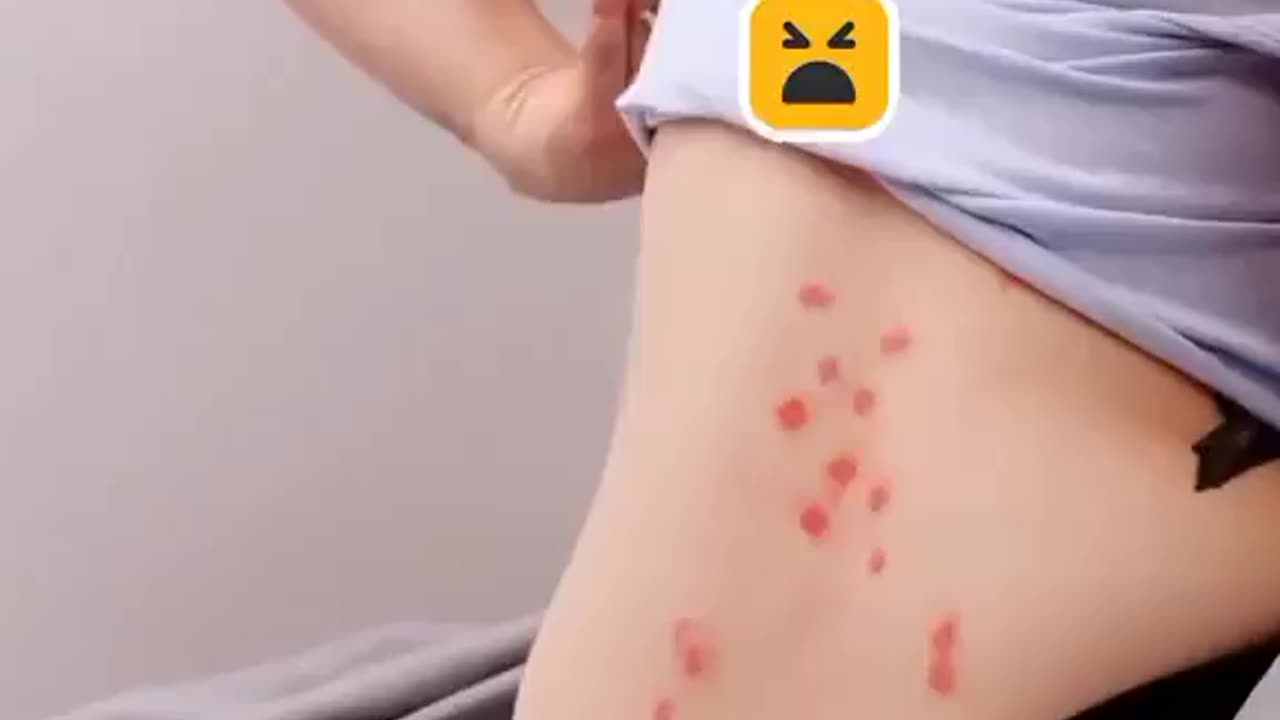 Insect tips