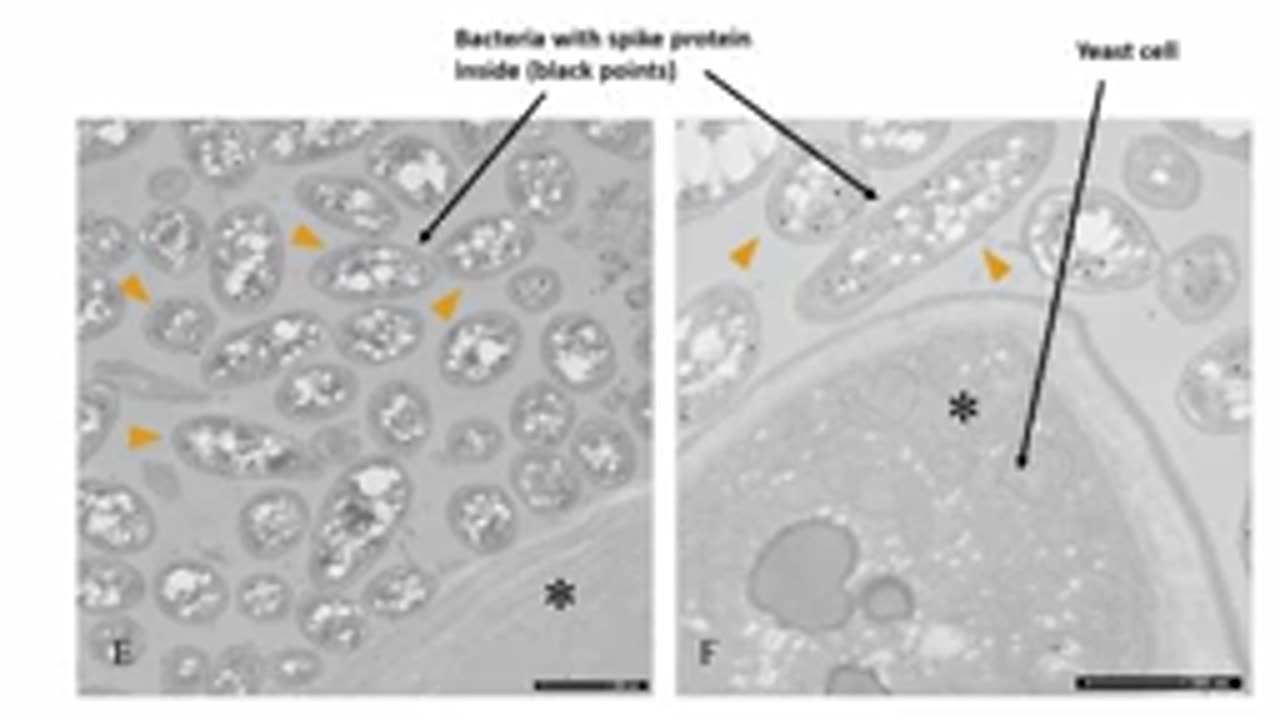 ANTIBIOTICS FOR COVID ?