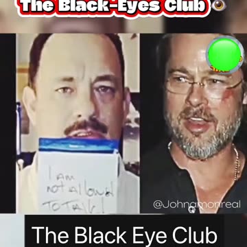 The Black Eye Club 🤦‍♂️🤬🤮⚠️