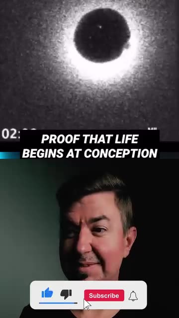 Proof That Life Begins At Conception