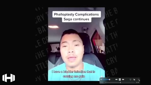 LGBTQ Frankenstein Transplant Horror Stories