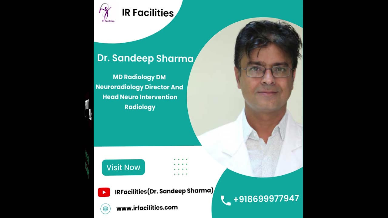 Left Varicocele Embolization by Dr. Sandeep Sharma at IRFACILITIES