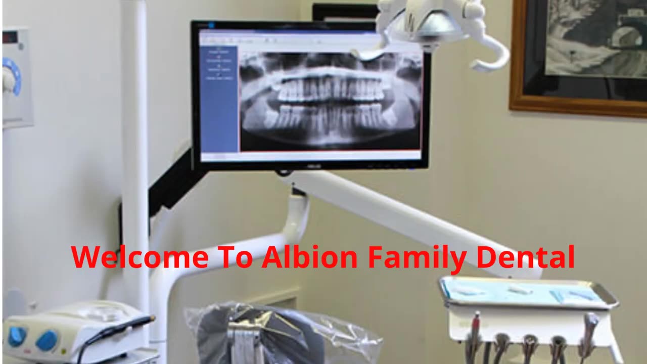 Albion Family Dental : Crown Implants in Albion | (585) 589-9044