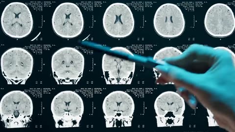 0:07 / 9:26 How Einstein's Brain was Different ?