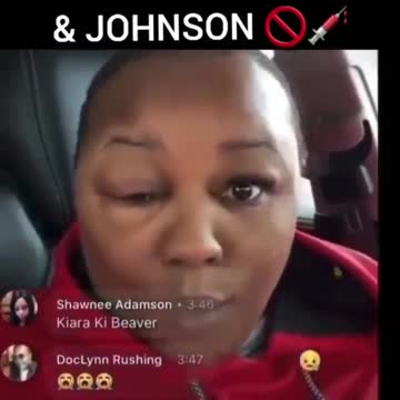 Reaction to Covid Vaccine what the media won't show you