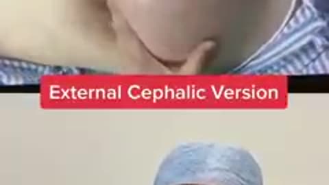 Medical: Turning a baby in the stomach