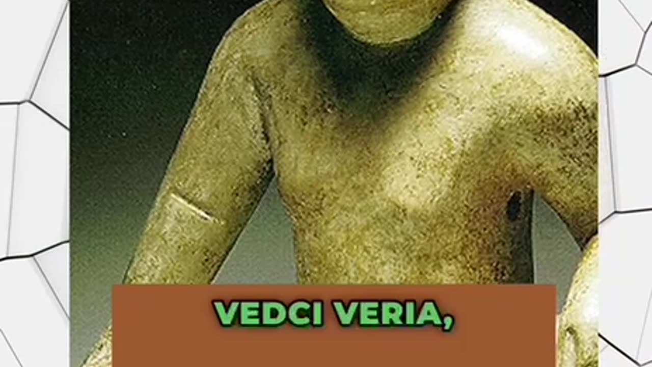 Downov syndróm