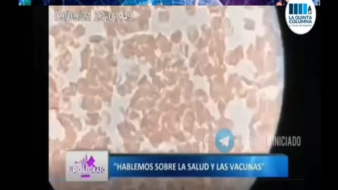 celula humana genetica modificada con puntas de espigas o spikes en sangre de vacunados covid